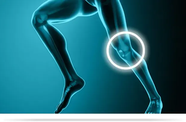 Knee Arthroscopy